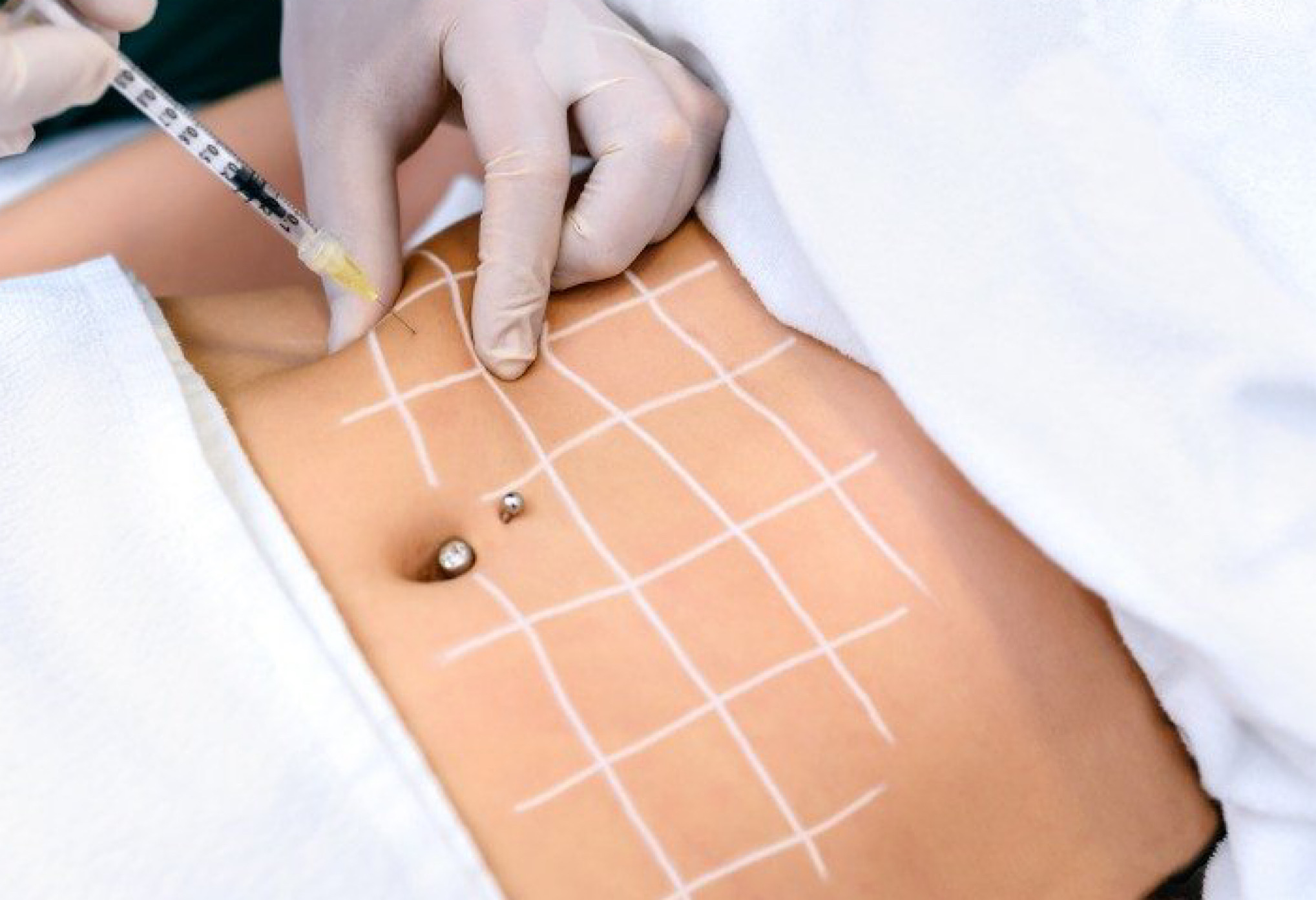 Введение препарата.