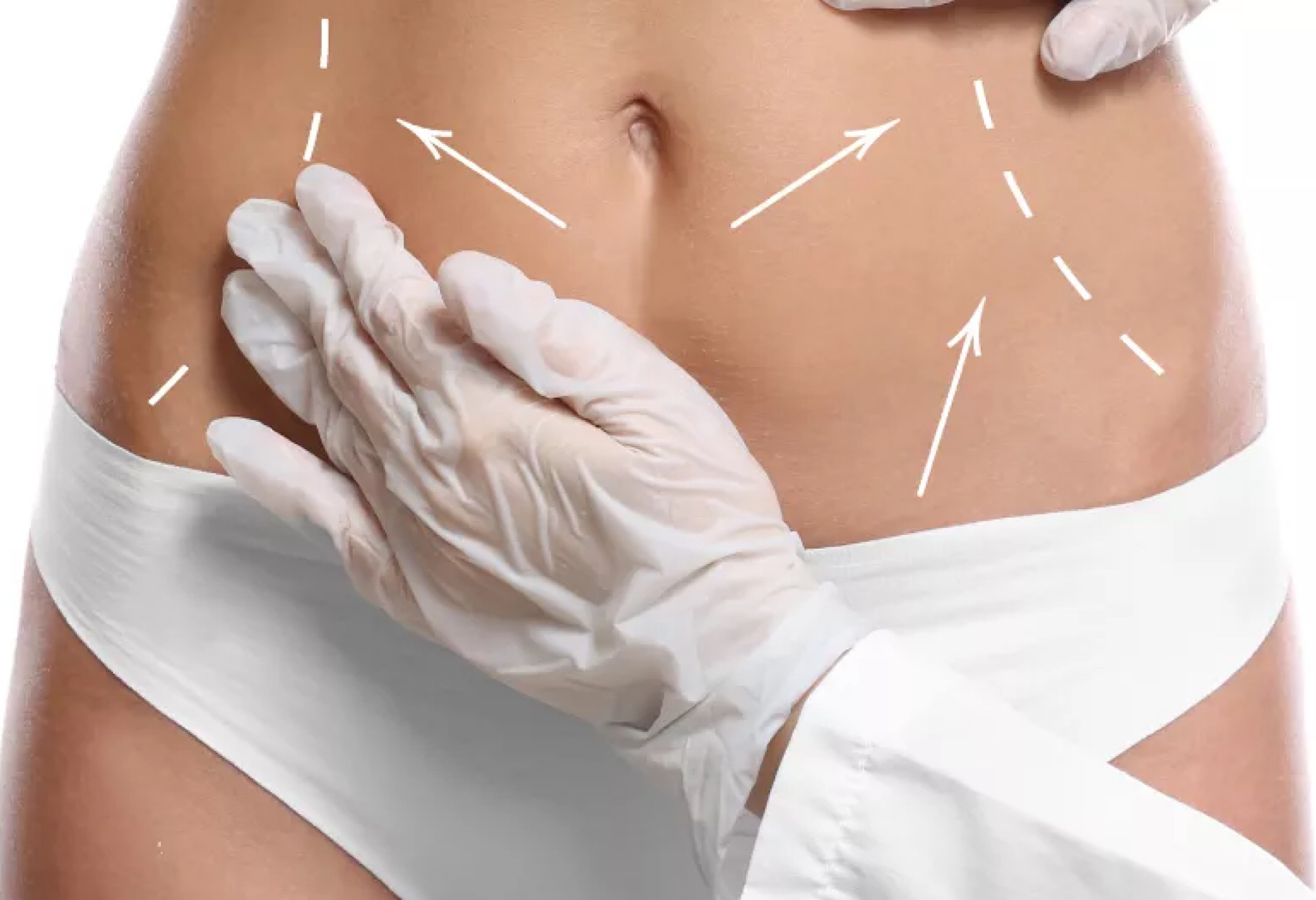 Подготовка к процедуре.