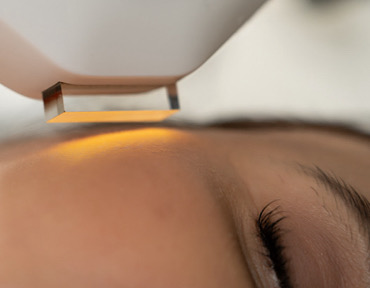 удаление пигментных пятен в барнауле