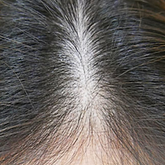 До процедуры