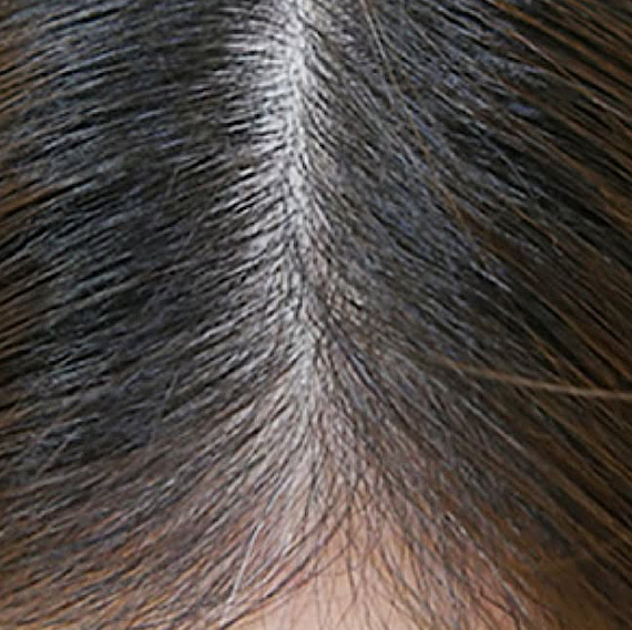 После процедуры