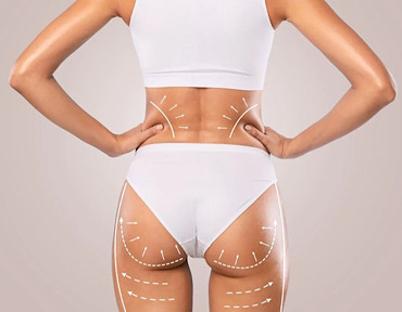 RF-лифтинг в барнауле