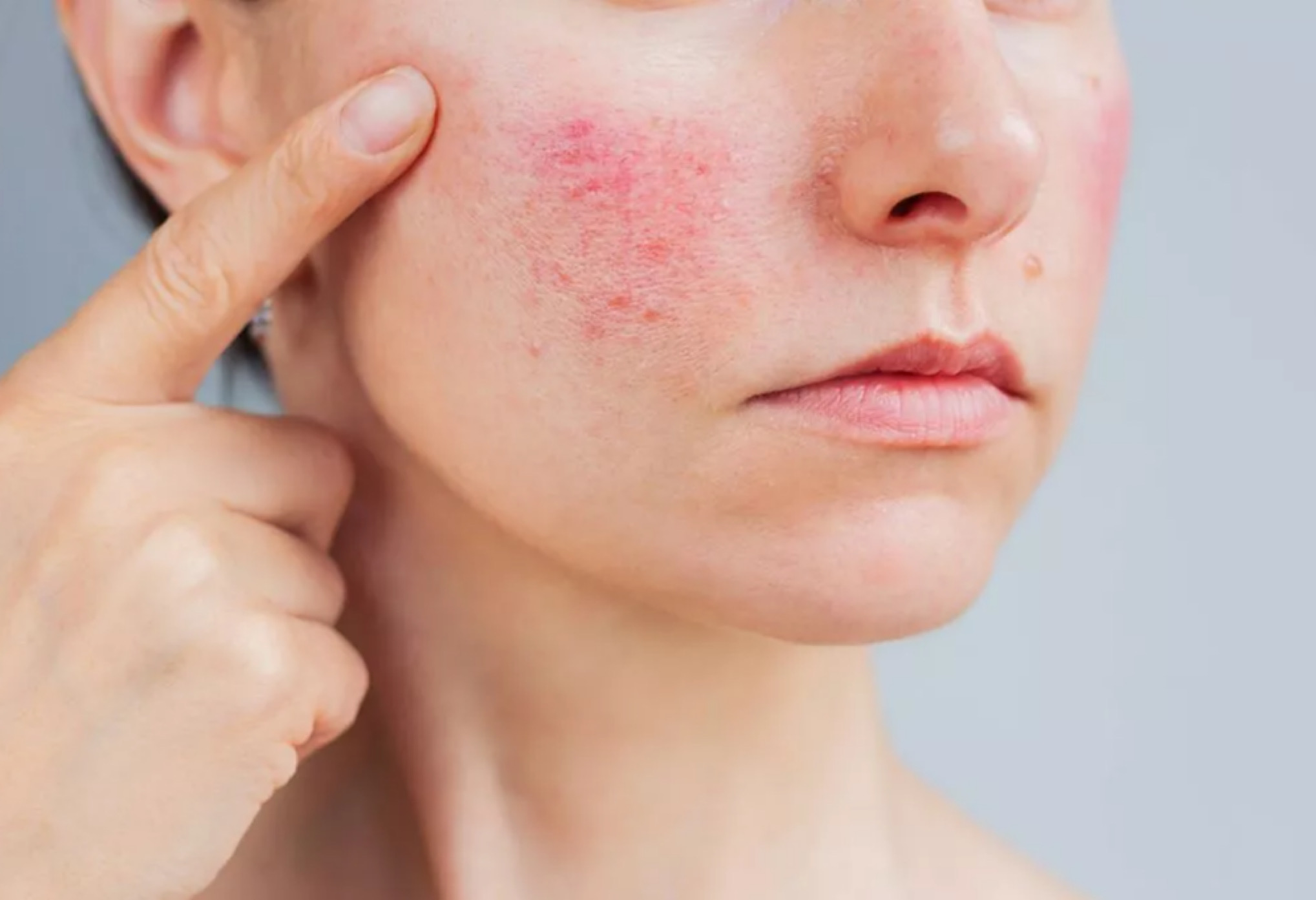 Подготовка к процедуре.