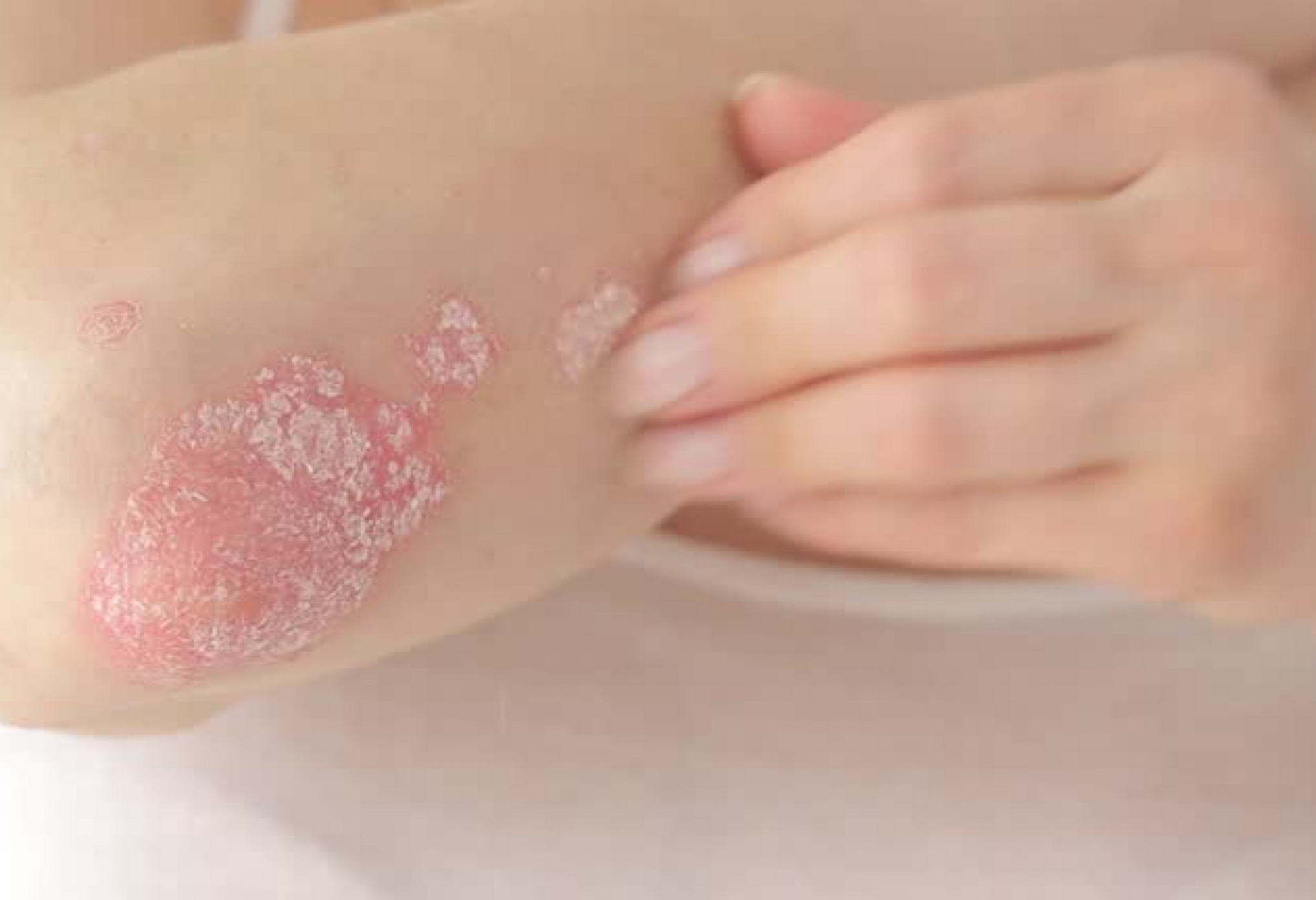 Подготовка к процедуре.