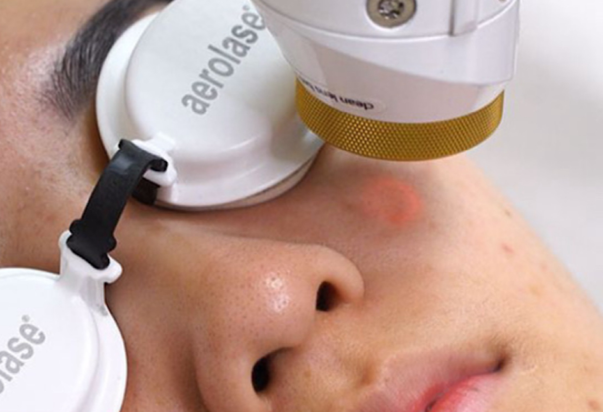 Проведение процедуры.