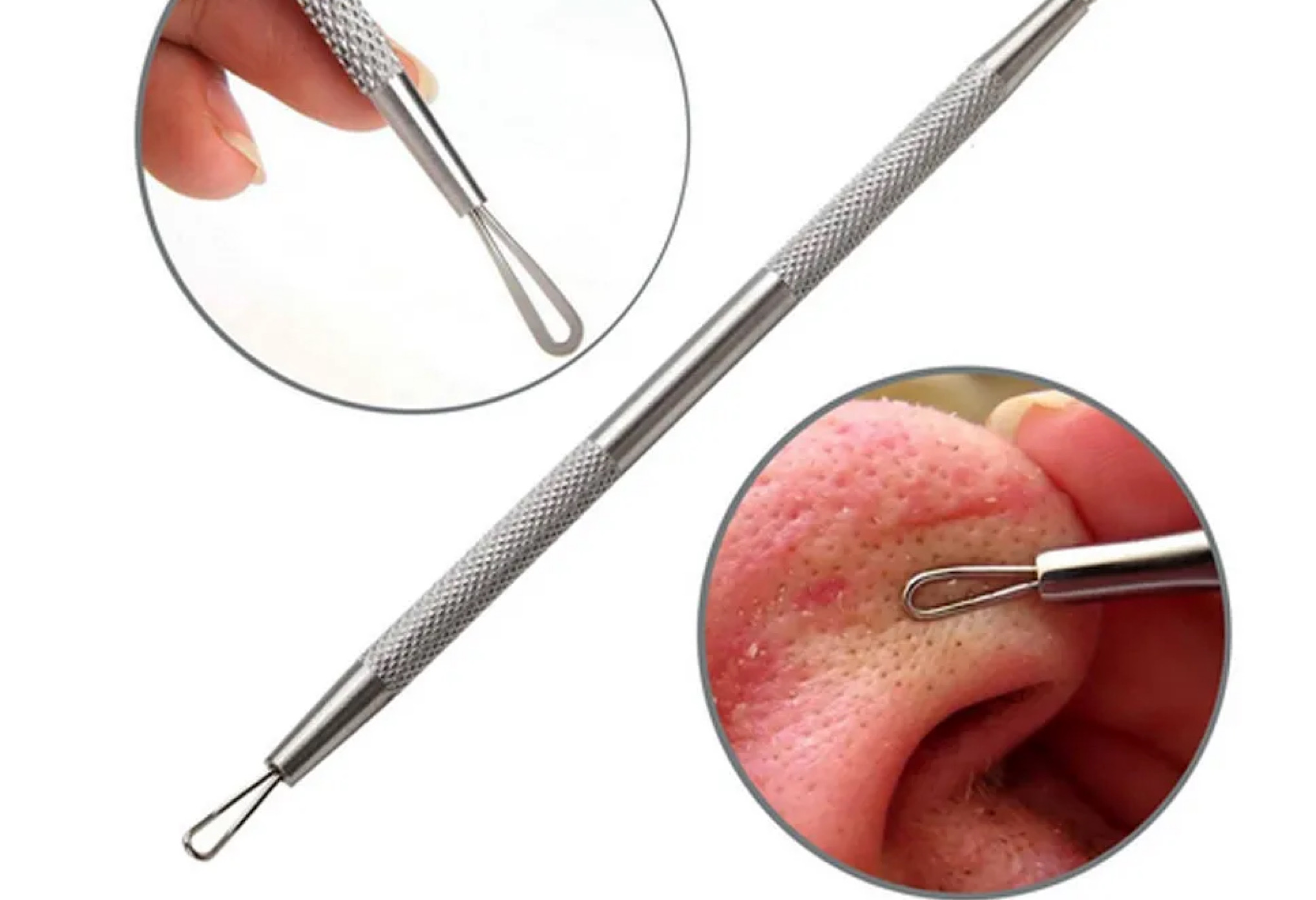 Проведение процедуры.