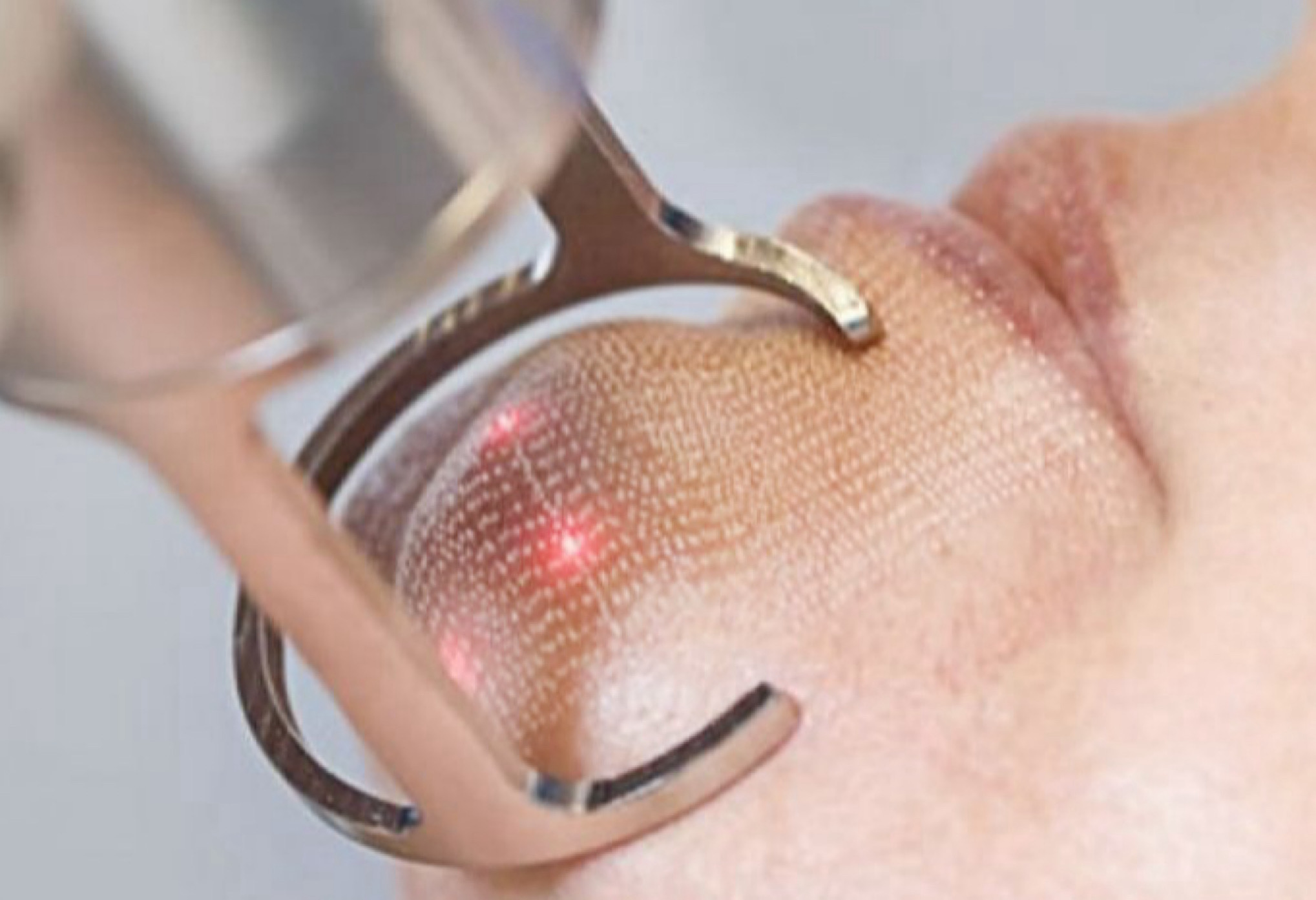 Проведение процедуры.