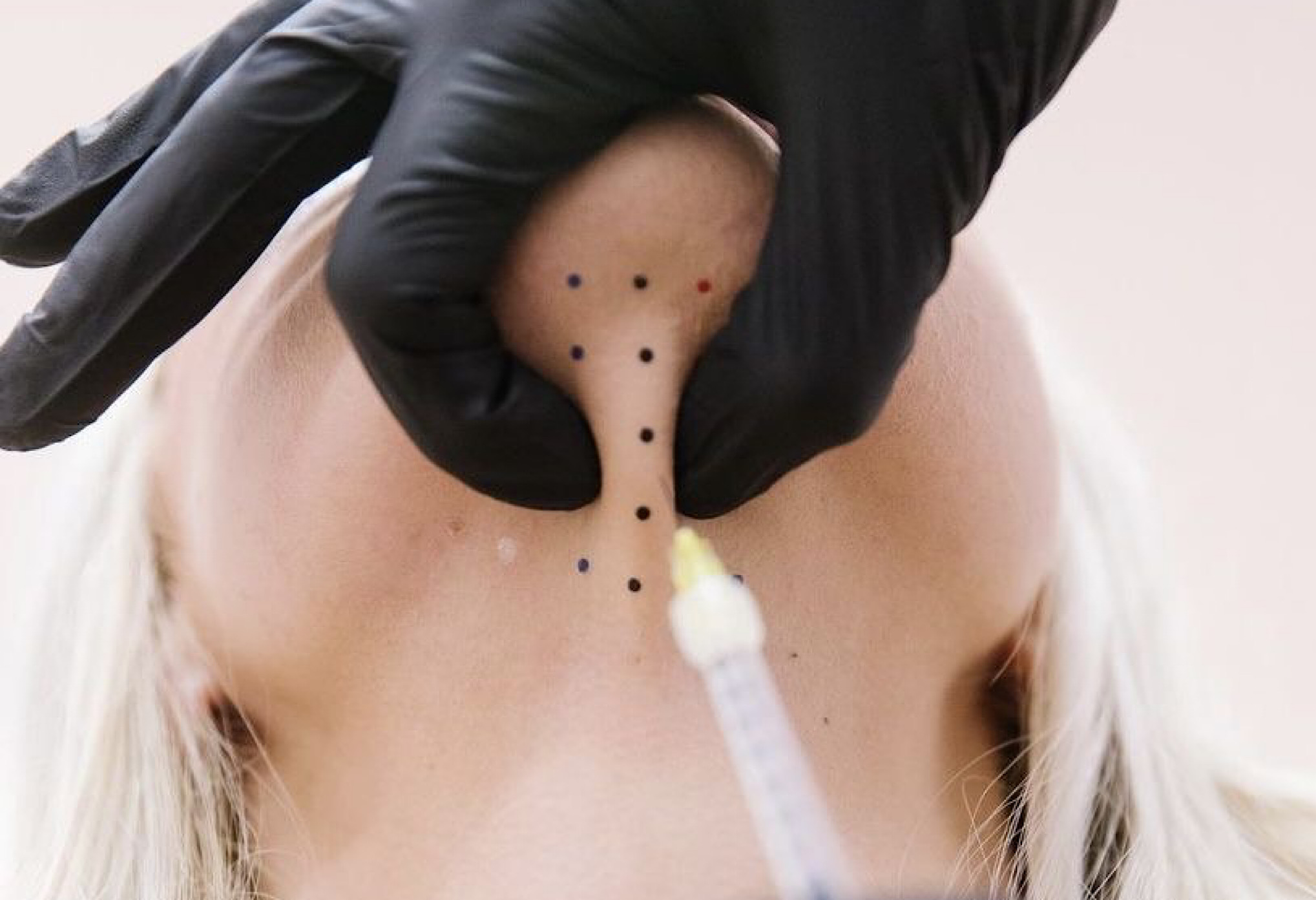 Повторный визит