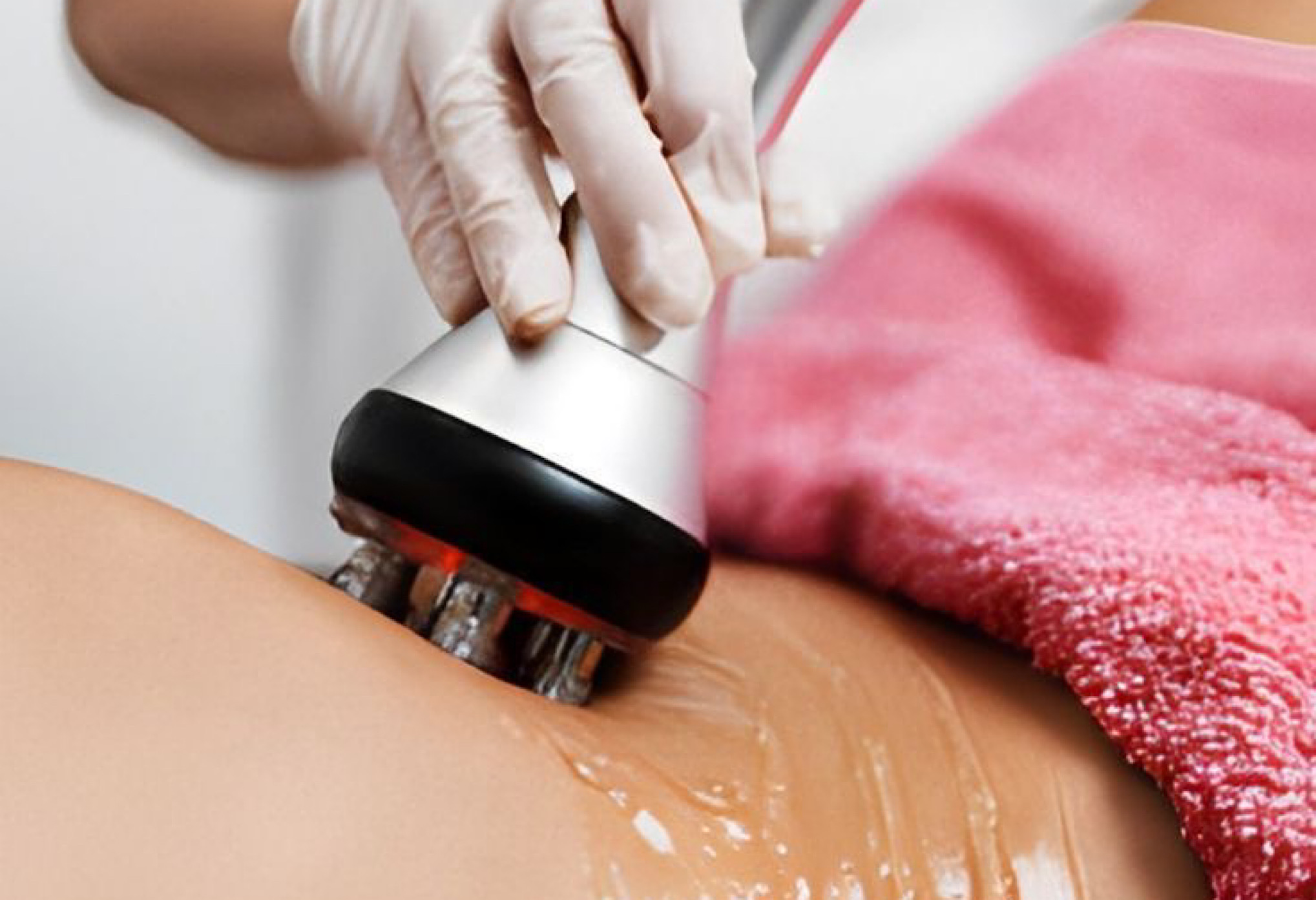 Проведение процедуры.