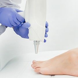 Лазерное лечение онихомикоза (грибок ногтей)